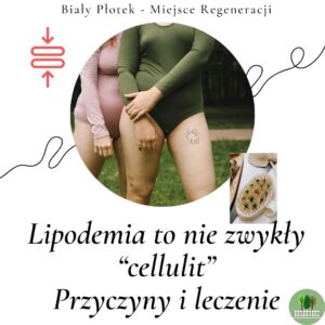 lipodemia