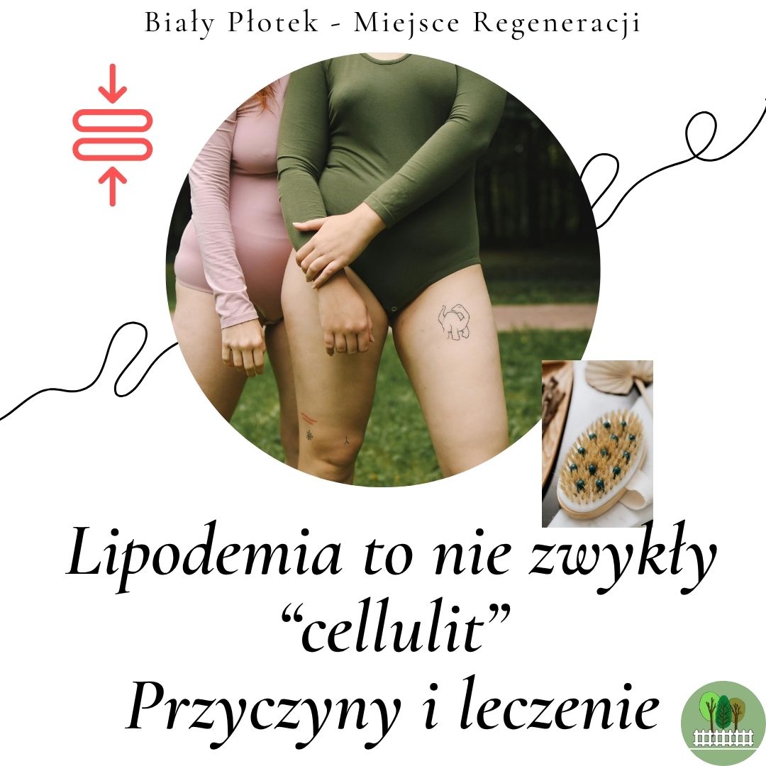 lipodemia
